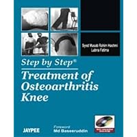 Step by Step: Treatment of Osteoarthritis Knee Step by Step: Treatment of Osteoarthritis Knee Paperback