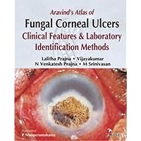 Aravind's Atlas of Fungal Corneal Ulcers Aravind's Atlas of Fungal Corneal Ulcers Hardcover Paperback