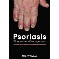 Psoriasis: Diagnosis and Management Psoriasis: Diagnosis and Management Kindle Hardcover