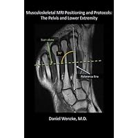 Musculoskeletal MRI Positioning and Protocols: The Pelvis and Lower Extremity