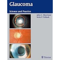 Glaucoma: Science and Practice Glaucoma: Science and Practice Hardcover Kindle