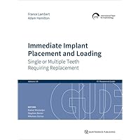 Immediate Implant Placement and Loading: Single or Multiple Teeth Requiring Replacement (ITI Treatment Guides, 14) Immediate Implant Placement and Loading: Single or Multiple Teeth Requiring Replacement (ITI Treatment Guides, 14) Hardcover Kindle