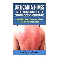 Urticaria Hives : Treatment Guide For Chronic Or Cholinergic: Remedies And Cures For Hives, Eczema And Psoriasis Urticaria Hives : Treatment Guide For Chronic Or Cholinergic: Remedies And Cures For Hives, Eczema And Psoriasis Paperback