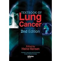 Textbook of Lung Cancer Textbook of Lung Cancer Hardcover