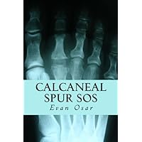 Calcaneal Spur SOS: How to Treat A Calcaneal Spur Naturally and Get Quick Relief from Foot Pain Calcaneal Spur SOS: How to Treat A Calcaneal Spur Naturally and Get Quick Relief from Foot Pain Paperback