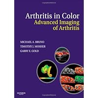 Arthritis in Color: Advanced Imaging of Arthritis Arthritis in Color: Advanced Imaging of Arthritis Hardcover