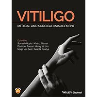 Vitiligo: Medical and Surgical Management Vitiligo: Medical and Surgical Management Kindle Hardcover
