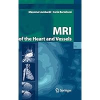 MRI of the Heart and Vessels MRI of the Heart and Vessels Kindle Hardcover Paperback
