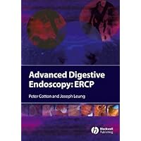 Advanced Digestive Endoscopy: ERCP Advanced Digestive Endoscopy: ERCP Kindle Hardcover
