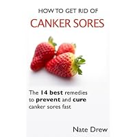 How to Get Rid of Canker Sores How to Get Rid of Canker Sores Kindle