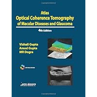 Atlas Optical Coherence Tomography of Macular Diseases and Glaucoma Atlas Optical Coherence Tomography of Macular Diseases and Glaucoma eTextbook Hardcover Paperback