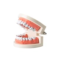 Dental Caries Study Model Decay Tooth Model Disease Standard Typodont Demonstration Teeth Model for Kids Oral Care Teaching
