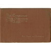 Some Common Skin Diseases: Charted and Illustrated for Ease in Diagnosis with Epitomized Treatment