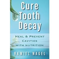 Cure Tooth Decay: Heal And Prevent Cavities With Nutrition - Limit And Avoid Dental Surgery and Fluoride [Second Edition] 5 Stars Cure Tooth Decay: Heal And Prevent Cavities With Nutrition - Limit And Avoid Dental Surgery and Fluoride [Second Edition] 5 Stars Kindle Paperback