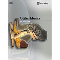 Otitis Media: An Overview (Otolaryngology)