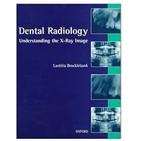 Dental Radiology: Understanding the X-Ray Image Dental Radiology: Understanding the X-Ray Image Paperback