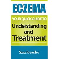 Eczema: Your Quick Guide to Understanding and Treatment Eczema: Your Quick Guide to Understanding and Treatment Paperback Kindle
