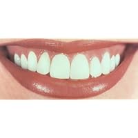 Smoke-Free Smiles: A Graphic & Educational Smoking Deterrent Presentation about the Ugly & Unhealthy Effects of Smoking to Your Teeth, Gums & SMILE!