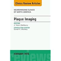 Plaque Imaging, An Issue of Neuroimaging Clinics of North America (The Clinics: Radiology) Plaque Imaging, An Issue of Neuroimaging Clinics of North America (The Clinics: Radiology) Kindle Hardcover