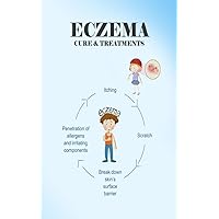 Eczema : Cure & Treatments (The Food Science) Eczema : Cure & Treatments (The Food Science) Kindle Paperback