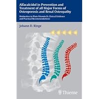 Alfacalcidol in Prevention and Treatment of all Major Forms of Osteoporosis and in Renal Osteopathy Alfacalcidol in Prevention and Treatment of all Major Forms of Osteoporosis and in Renal Osteopathy Paperback