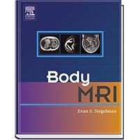Body MRI Body MRI Hardcover
