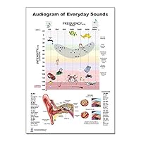 Audiogram of Everyday Sound Poster 12x17inch, Audiologist, Speech Banana, Waterproof, Show Frequency, Pitch and Ear Infomation