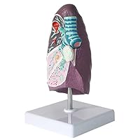 Teaching Model,Model of a Smoke Lung 2:3 Human Lung Anatomical Model wirh Pathological Features & Clear Texture & Accurate Anatomy Structure for Teaching Models Doctor-Patient Comm