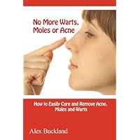 No More Warts, Moles or Acne: How to Cure and Remove Acne, Moles and Acn e No More Warts, Moles or Acne: How to Cure and Remove Acne, Moles and Acn e Paperback