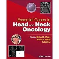 Essential Cases in Head and Neck Oncology Essential Cases in Head and Neck Oncology Kindle Paperback