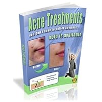 Acne Treatments: you don't have to suffer anymore... help is available