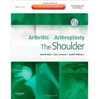 Arthritis and Arthroplasty: The Shoulder: Expert Consult - Online, Print and DVD Arthritis and Arthroplasty: The Shoulder: Expert Consult - Online, Print and DVD Hardcover