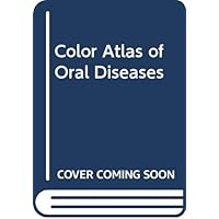 Color Atlas of Oral Diseases Color Atlas of Oral Diseases Hardcover