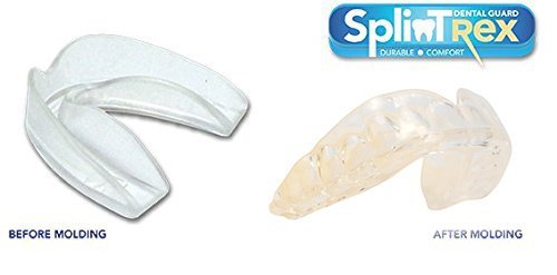 SplinTrex Multi Use Teeth Mouth Guards - 4 Pack - BPA Free - Teeth Grinding Dental Night Guard, Athletic Mouth Guard, Teeth Whitening Tray - Includes 4 Customizable Mouth Guards and Storage Case