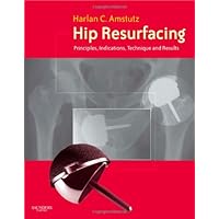 Hip Resurfacing: Principles, Indications, Technique and Results Book and DVD Hip Resurfacing: Principles, Indications, Technique and Results Book and DVD Hardcover