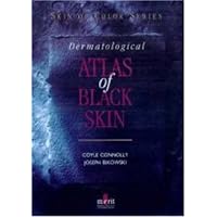 Dermatological Atlas of Black Skin Dermatological Atlas of Black Skin Hardcover Paperback