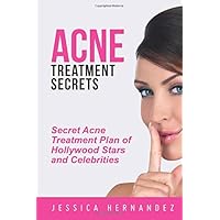 Acne Treatment Secrets: Secret Acne Treatment Plan of Hollywood Stars and Celebrities