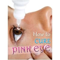 How To Cure Pink Eye How To Cure Pink Eye Kindle