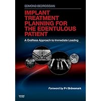 Implant Treatment Planning for the Edentulous Patient: A Graftless Approach to Immediate Loading Implant Treatment Planning for the Edentulous Patient: A Graftless Approach to Immediate Loading Hardcover Kindle