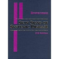 Skin Signs of Systemic Disease Skin Signs of Systemic Disease Hardcover