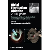 Atrial Fibrillation Ablation, 2011 Update: The State of the Art based on the VeniceChart International Consensus Document Atrial Fibrillation Ablation, 2011 Update: The State of the Art based on the VeniceChart International Consensus Document Kindle Paperback
