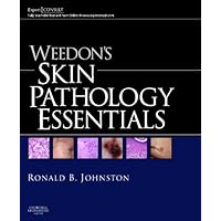 Weedon's Skin Pathology Essentials: Expert Consult: Online and Print Weedon's Skin Pathology Essentials: Expert Consult: Online and Print Hardcover