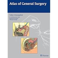 Atlas of General Surgery Atlas of General Surgery Kindle Hardcover Plastic Comb