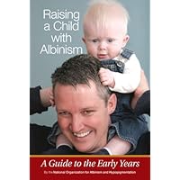 Raising a Child With Albinism: A Guide to the Early Years Raising a Child With Albinism: A Guide to the Early Years Paperback Kindle