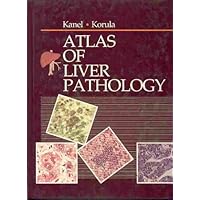 Atlas of Liver Pathology (Atlases in Diagnostic Surgical Pathology) Atlas of Liver Pathology (Atlases in Diagnostic Surgical Pathology) Hardcover