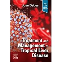Treatment and Management of Tropical Liver Disease Treatment and Management of Tropical Liver Disease Paperback Kindle