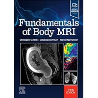 Fundamentals of Body MRI (Fundamentals of Radiology) Fundamentals of Body MRI (Fundamentals of Radiology) Paperback Kindle