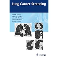 Lung Cancer Screening Lung Cancer Screening Kindle Paperback