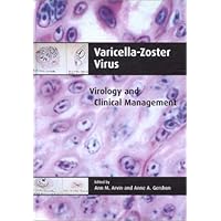 Varicella-Zoster Virus: Virology and Clinical Management Varicella-Zoster Virus: Virology and Clinical Management Hardcover
