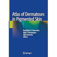 Atlas of Dermatoses in Pigmented Skin Atlas of Dermatoses in Pigmented Skin Hardcover Paperback